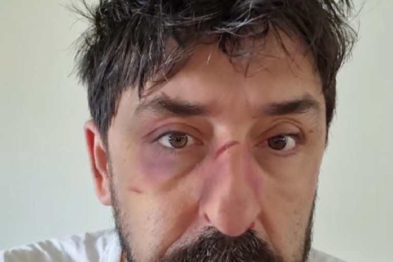 Ognjen Amidžić Instagram