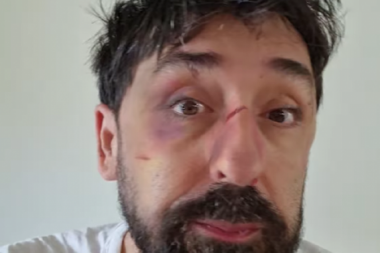 Ognjen Amidžić Instagram