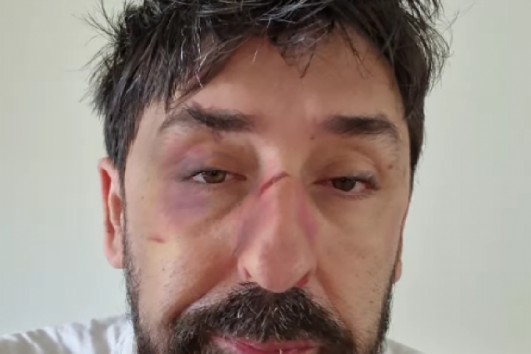 Ognjen Amidžić Instagram