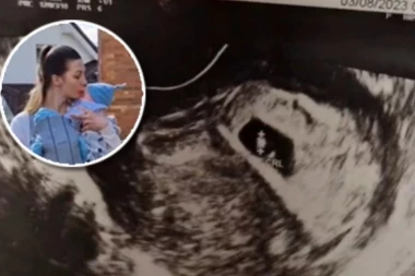 MILANI SU REKLI DA ČEKA BLIZANCE: Sve do porođaja nije imala pojma šta će se desiti