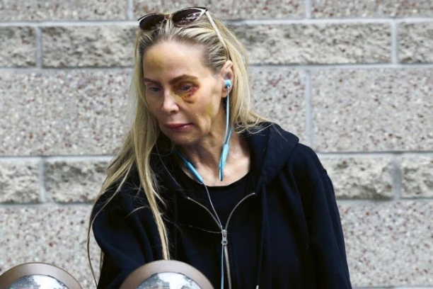 "OČAJNIČKI SAM MOLILA DA GA PRIVEDU": Oglasila se bivša žena Nikolasa Kejdža koju je sin BRUTALNO PRETUKAO: "Njegov tata je uvek bio zauzet"