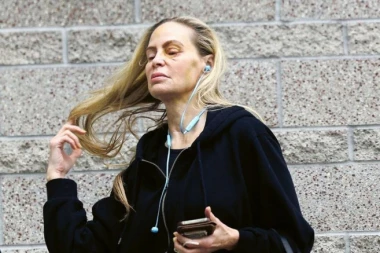 UZNEMIRUJUĆI SADRŽAJ! Pojavile se prve fotke PRETUČENE glumice, uslikana sa STRAVIČNIM MODRICAMA! (GALERIJA)