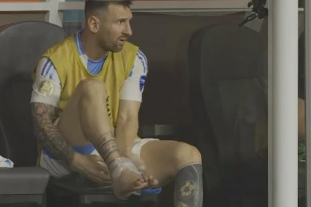 MESI MORA DA PAUZIRA ZBOG POVREDE: Evo kako je zaradio GROZAN udarac (VIDEO)