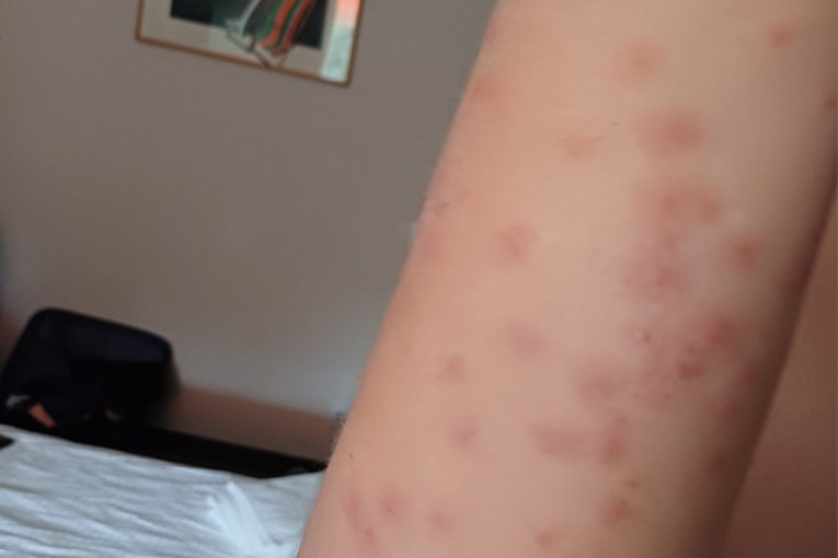 Decu u hotelu na Ohridu unakazile stenice