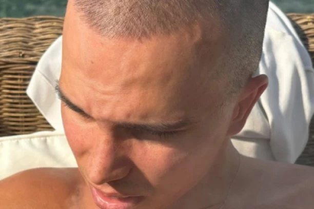 ŠTA MU JE SA LICEM?! Vojaž potpuno UNAKAŽEN NAKON RASKIDA , fanovi u ŠOKU zbog onoga što mu se desilo! (FOTO)