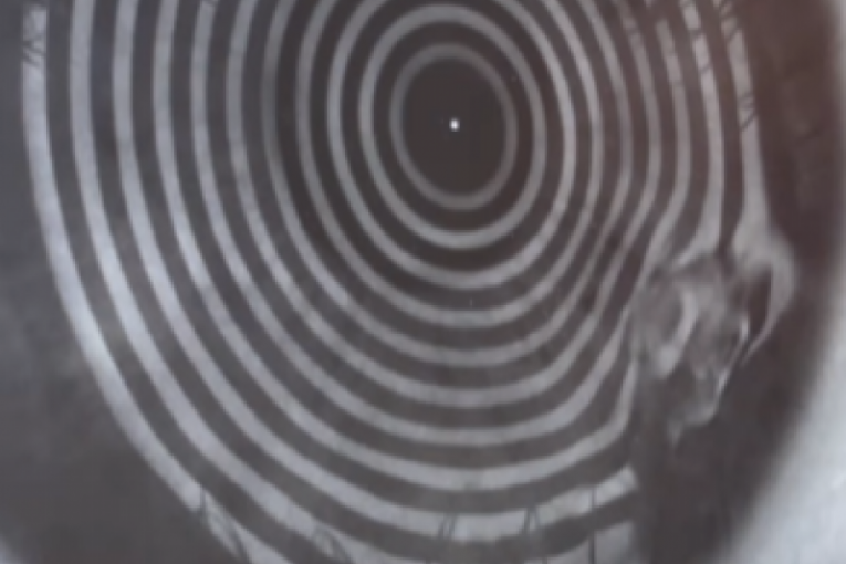 Lani Jurčević ćerka povredila oko, oštećena rožnjača