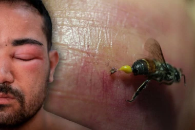 OSE SU GA UBOLE 160 PUTA, HILJADE POBESNELIH INSEKATA GA NAPALE ISPOD TUŠA: Pokušao da im pobegne, ali uzalud