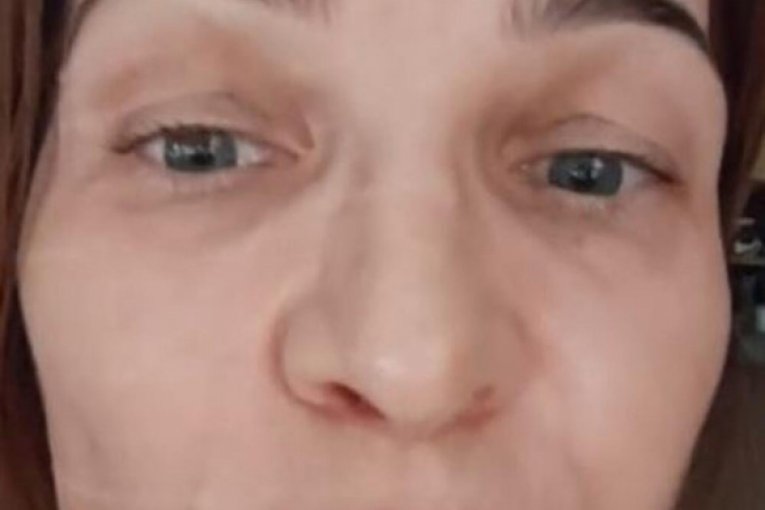 Natalija Trik Fx bez šminke