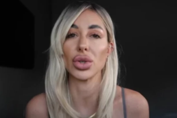 OVE SLIKE BI SIGURNO ZABRANILA! Ovako je nekada izgledala Zorannah, uz ESTETSKE KOREKCIJE promenila lični opis!