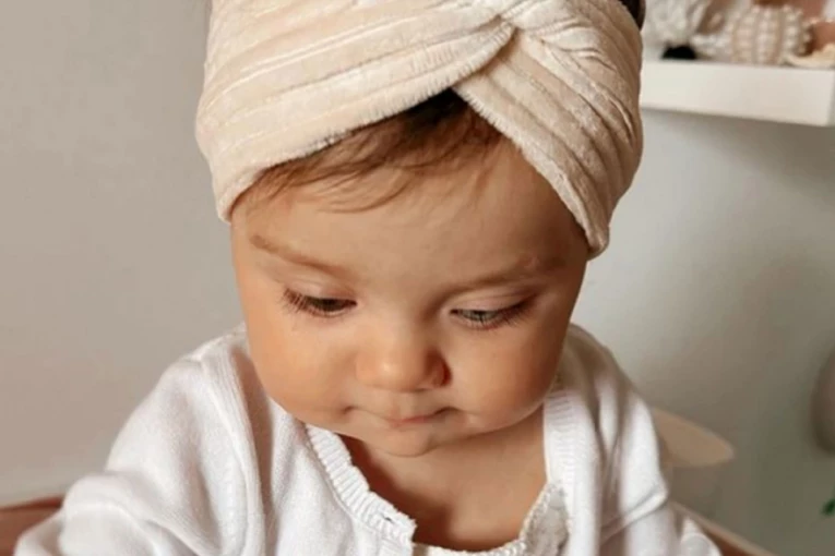 OVA DEVOJČICA IMA STANJE KOJE POGAĐA ŽIVOTINJE: Ona je medicinski fenomen!