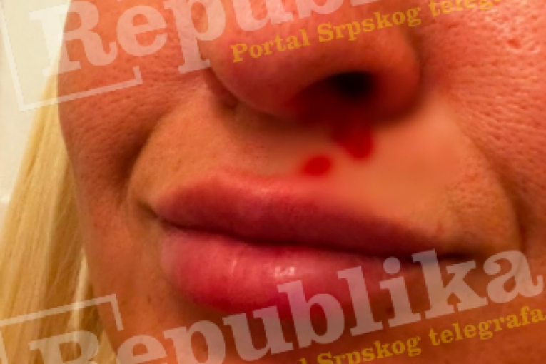 Matea Stanković Elita 8 