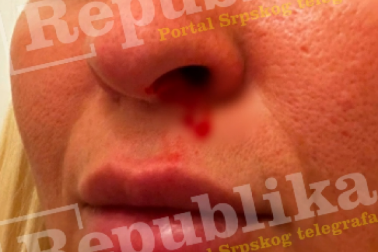 Matea Stanković Elita 8 