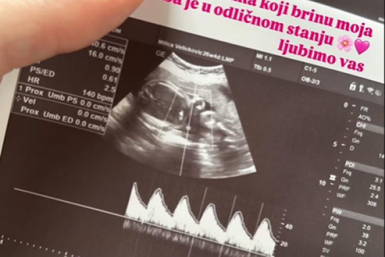 Milica Veličković trudna