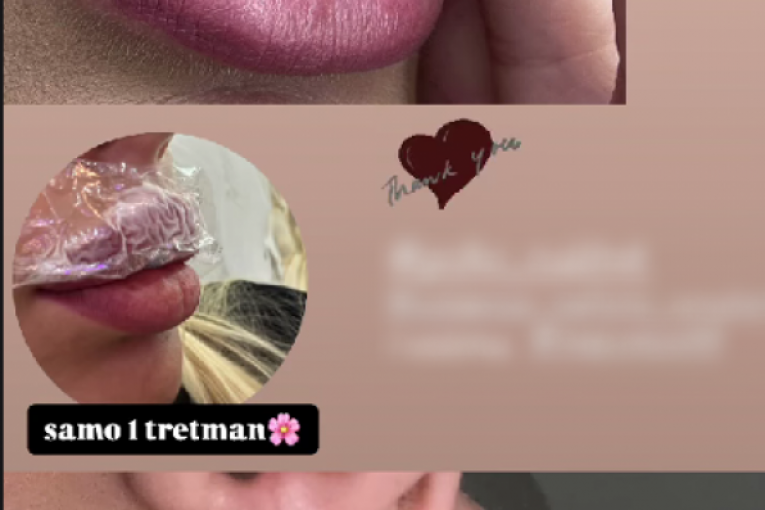 Ivana Šopić Instagram