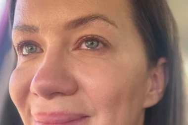 OPERISANA NAŠA INFLUENSERKA: Otkrila da ima RAK, a sada je objavila kako se oseća nakon UKLANJANJA neprijatelja!