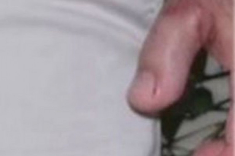 Povrede na ruci hirurga