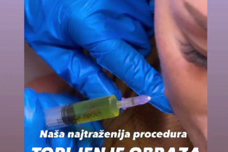 Ana Radulović Instagram