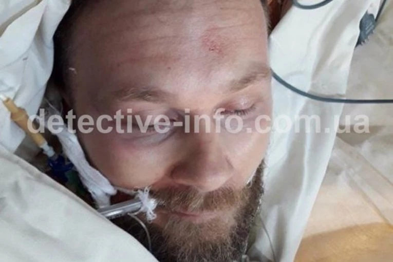 ZVICER LEŽI U ZAVOJIMA, SAV KRVAV, SA CEVKOM U USTIMA! Nakon pokušaja ubistva osvanule slike vođe kavčana! Tamara ga spasila u zadnji čas! (FOTO)