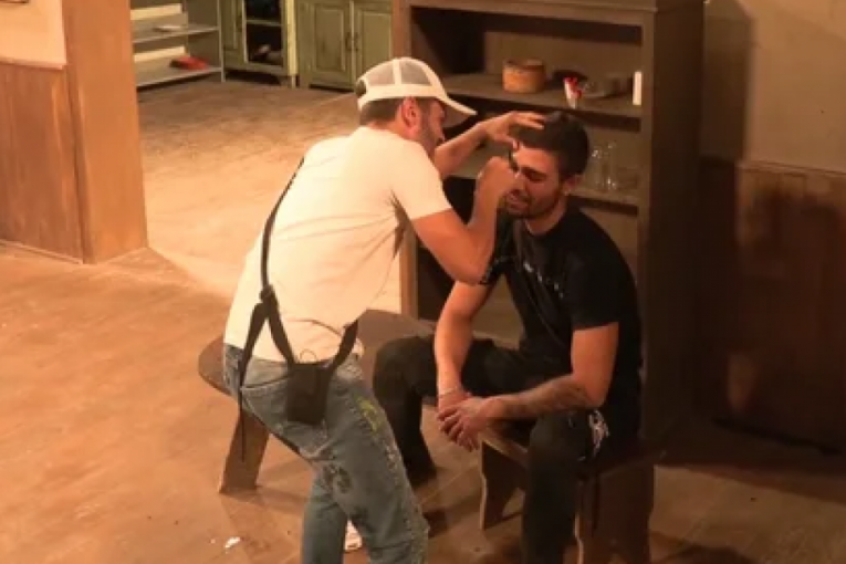 Ognjen Ravić ostao bez desne obrve Farma 8