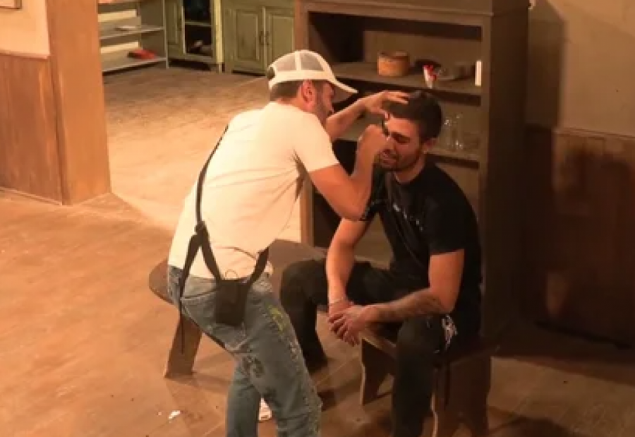 Ognjen Ravić ostao bez desne obrve Farma 8