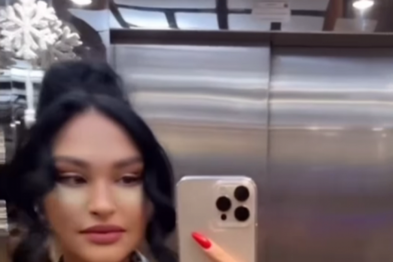 Ljupka Stević nakon operacije lica