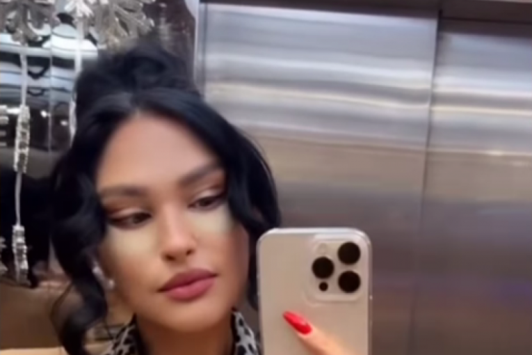 Ljupka Stević nakon operacije lica