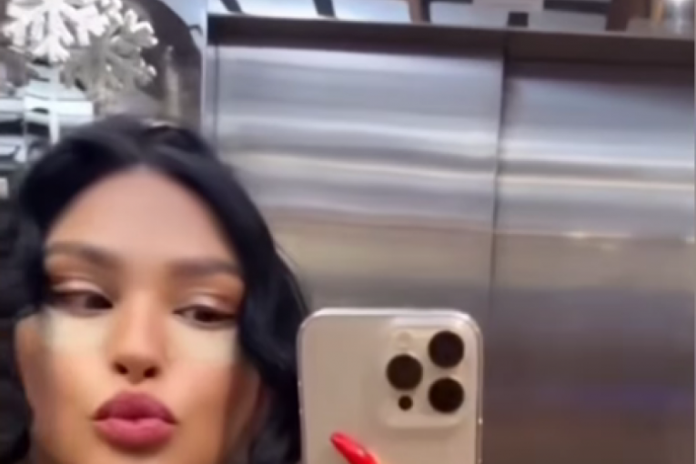 Ljupka Stević nakon operacije lica