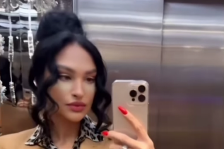 Ljupka Stević nakon operacije lica