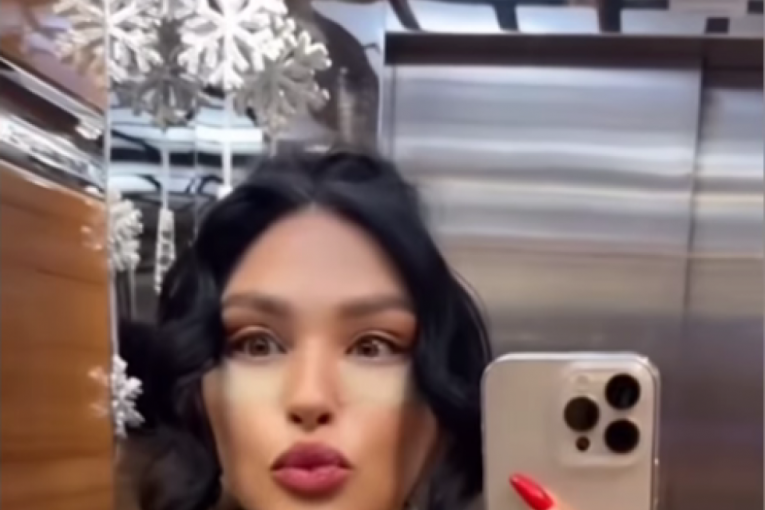 Ljupka Stević nakon operacije lica