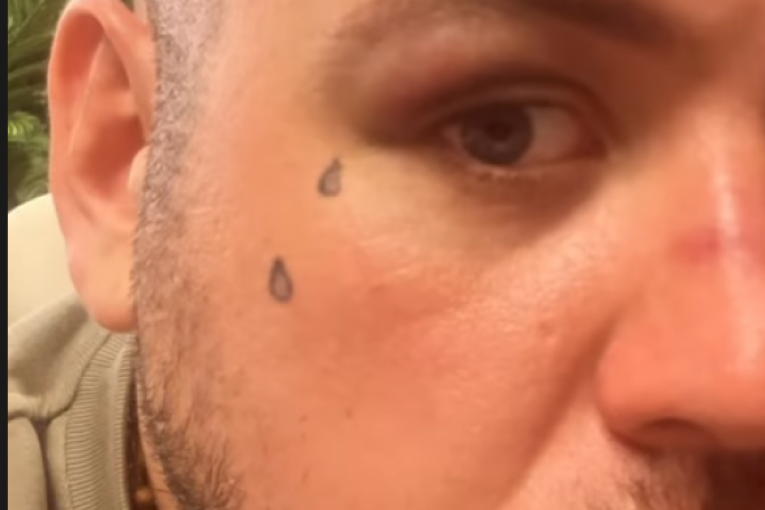 Filip Car nakon borbe