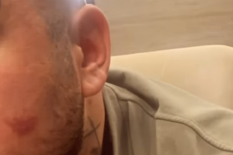 Filip Car nakon borbe