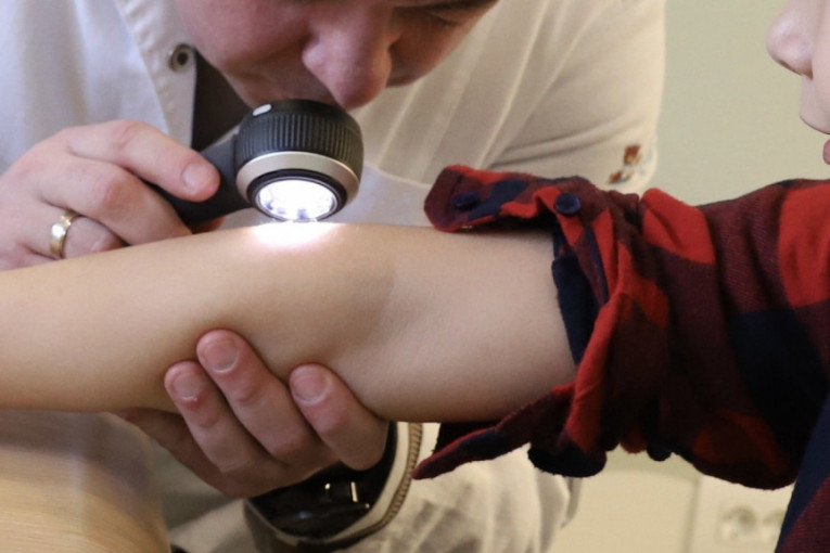 Zakažite besplatne dermatološke preglede, analizu krvne slike i CRP 15. februara za svoje mališane u klinici "Prime Medical Kids"