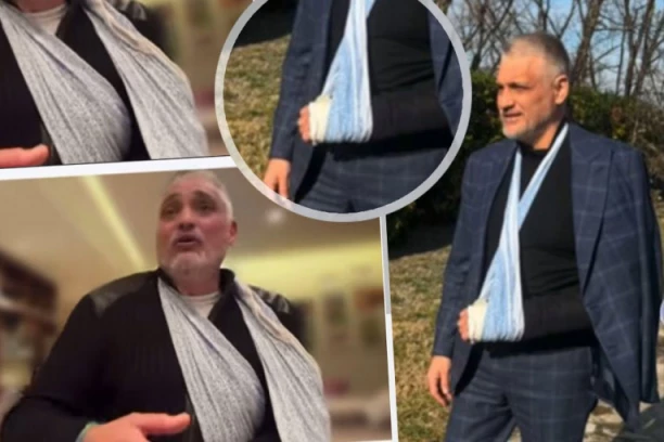 SAZNAJEMO! Čeda kukao na sav glas kako su mu trojica napadača slomila ruku, A U TUŽILAŠTVU ISPRIČAO POTPUNO DRUGU PRIČU!