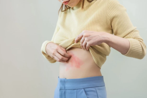 DA, MOŽETE DA BUDETE ALERGIČNI I NA HLADNOĆU! Ovo su prvi simptomi koje ne smete da ignorišete