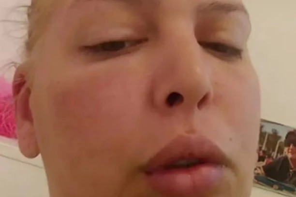 PUCAJU SILIKONI, PRETI JOJ SEPSA! Starleta iz rijalitija  traži 15.000 EVRA ZA NOVE GRUDI  - EVO ŠTA NUDI ZAUZVRAT!