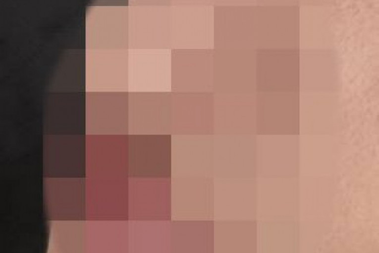 Povrede koje je zadobio pretučeni dečak!