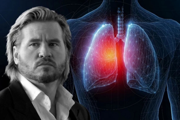 LEGENDARNI VAL KILMER JE PREMINUO OD NAIZGLED BEZAZLENE BOLESTI: Dr Radulović upozorila - svako može da oboli, ovo su simptomi koje Srbi zanemaruju