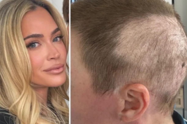 KOSA JOJ JE OTPALA, RANE SE PROŠIRILE PO CELOM TELU! Otac rijaliti-zvezde sprema sahranu, podkmula bolest RAZORILA ORGANIZAM mlade zvezde!