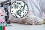 SMRTONOSAN VIRUS HARA BOSNOM I HERCEGOVINOM! Bolest se prenosi putem komarca ili direktnim kontaktom - svima naloženo da nose zaštitne rukavice!