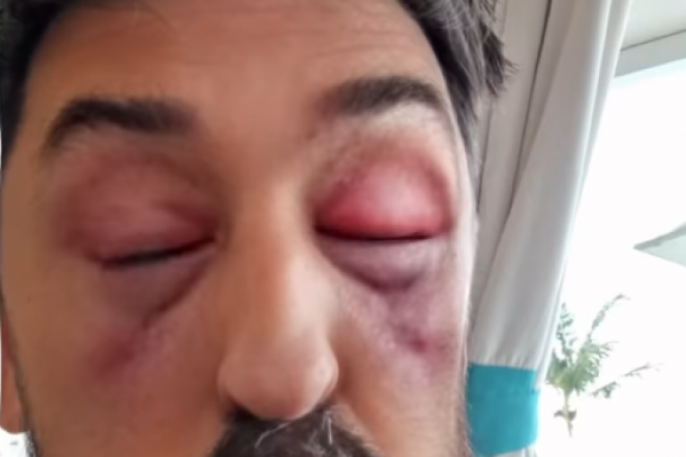 Ognjen Admižić Instagram