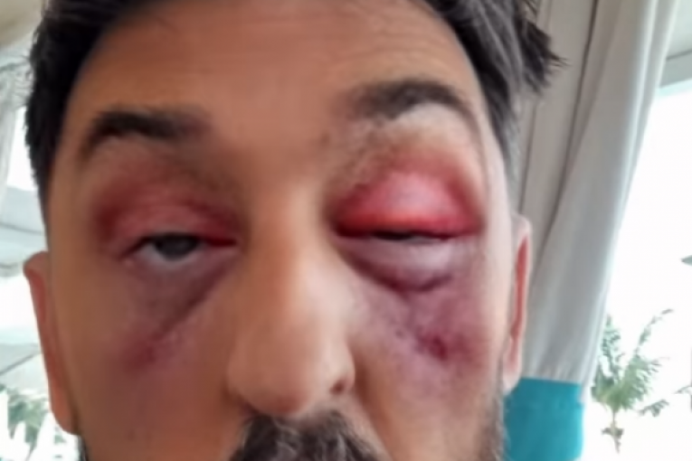 Ognjen Admižić Instagram