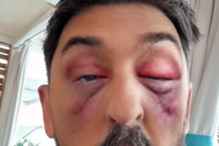 Ognjen Admižić Instagram