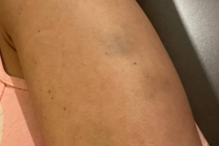 Maja Marinković pretučena Filip Car Zadruga Elita