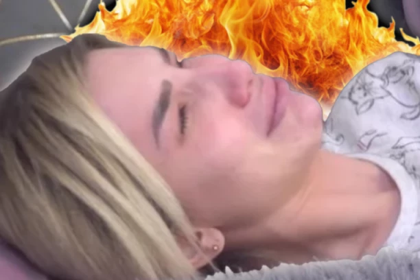 OPEKOTINE PREKRILE CELO TELO, KOŽA JOJ POTPUNO SPALJENA! Aleks Nikolić NAGRABUSILA, uznemirujuć snimak kruži mrežama! (FOTO)