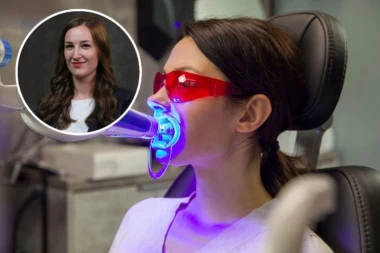 DA LI JE BOLJE ORDINACIJSKO ILI KUĆNO BELJENJE ZUBA? Stomatolog otkriva šta više šteti, ali i koja je opcija efikasnija (VIDEO)