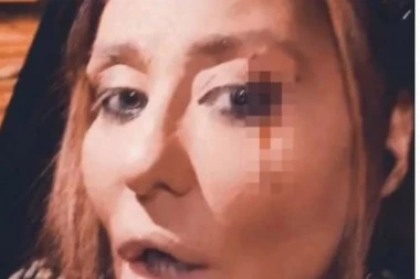 OGLASILA SE ANA NIKOLIĆ! Ovo je istina o prebijanju pevačice!