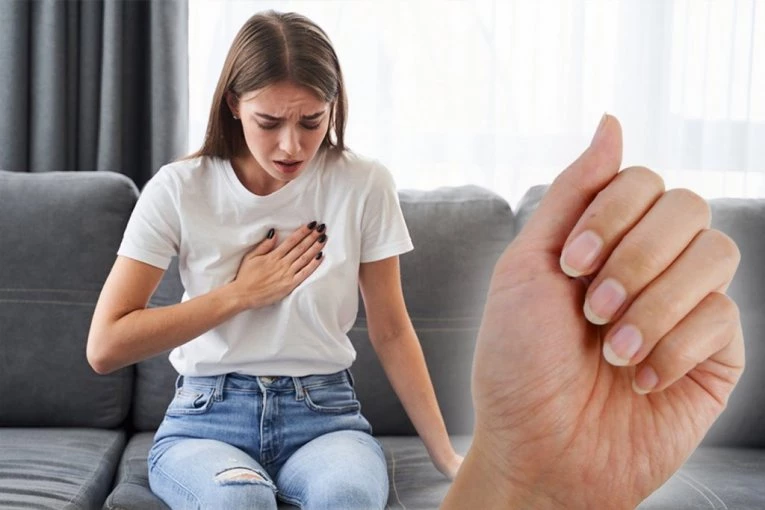 JASAN ZNAK VISOKOG HOLESTEROLA VIDI SE NA NOKTIMA: Ne ignorišite simptome koji vode ka začepljenju arterija i infarktu!