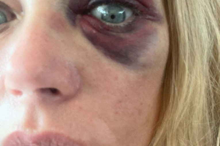 Deniz Ričards i Aron Fajpers