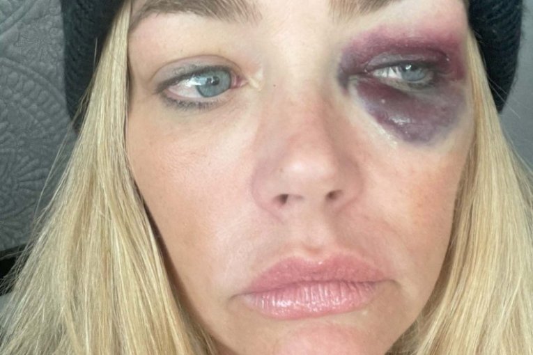 Deniz Ričards i Aron Fajpers