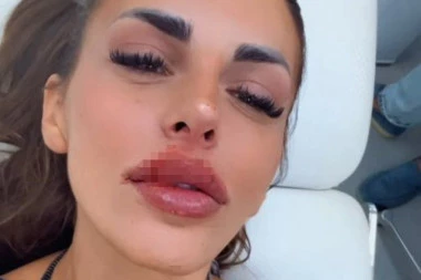 KRVAVA ENA ČOLIĆ! Učesnica "Elite 8" OBELODANILA SVE, evo šta se zapravo dogodilo! (VIDEO)